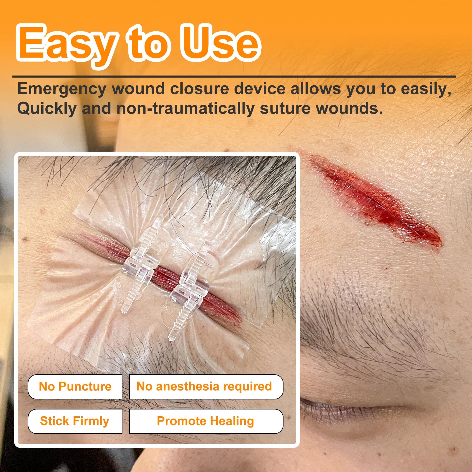Zipper Painless Wound Closure Device Suture-free Emergency Laceration Closure Strips Kit