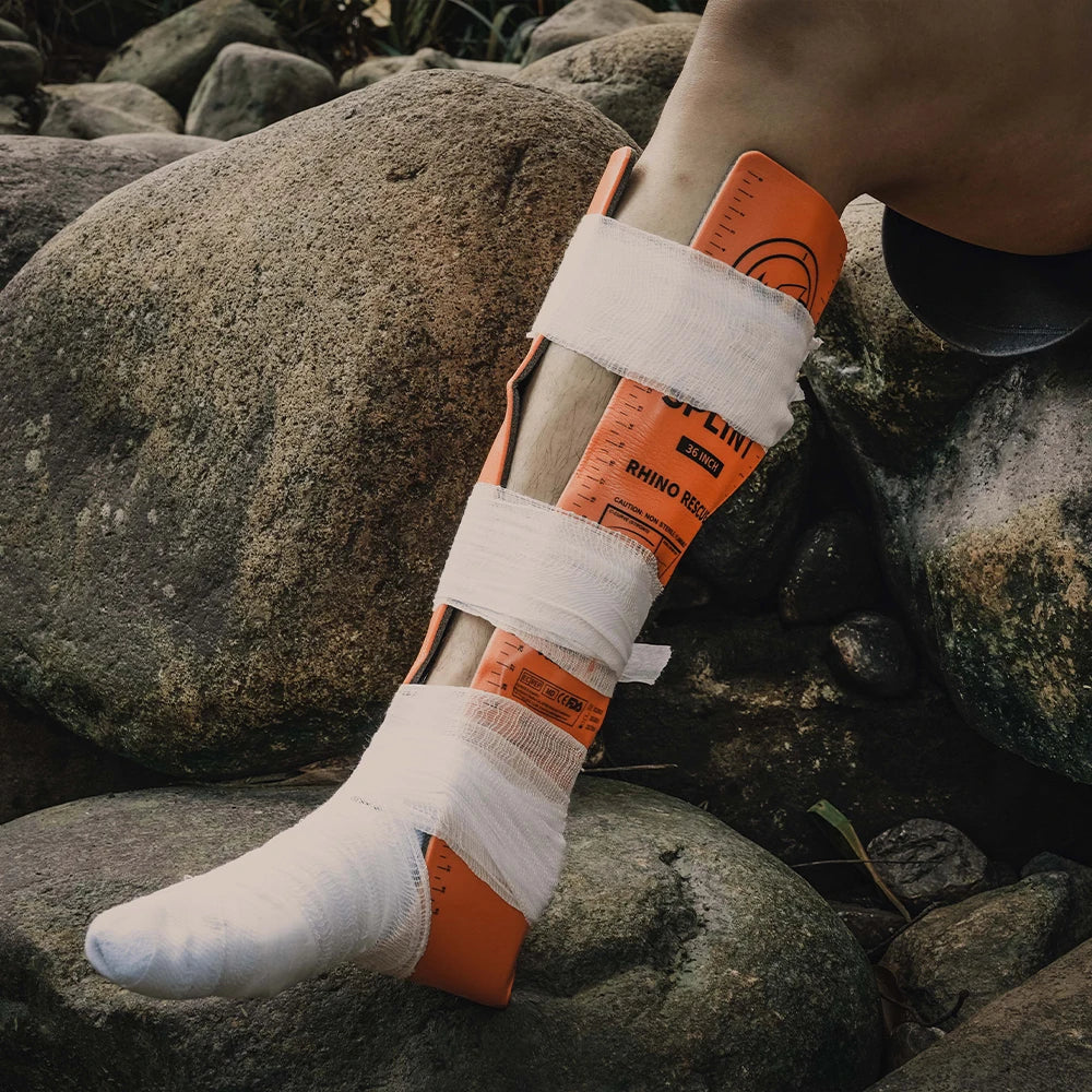 Rhino Rescue First Aid Splint, Lightweight & Reusable Bone Fracture Support, Medical Splint